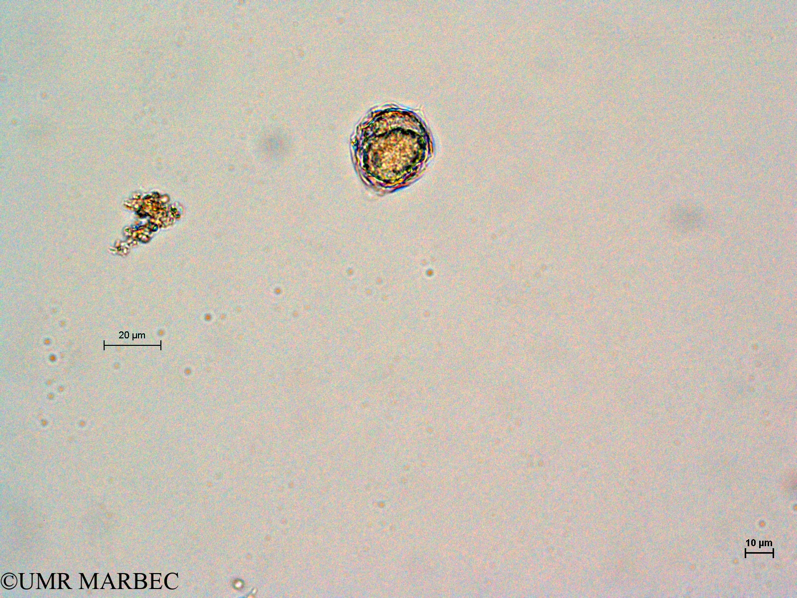 phyto/Thau_Lagoon/THAU_station1/GELAMED 2010/Protoperidinium curvipes (ancien Protoperidinium sp21 -P. pellucidum-4)(copy).jpg